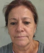 Depoimento de profissional certificado em RPPS